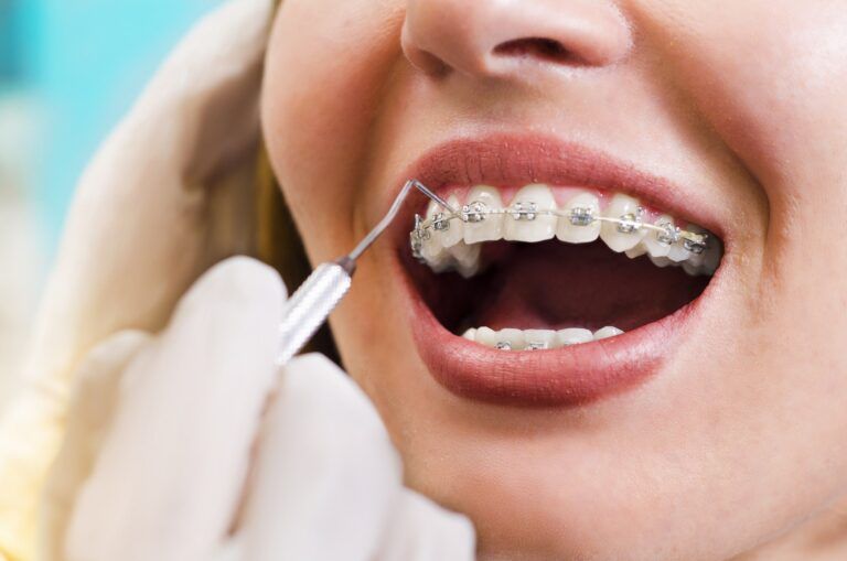 Aparelhos Dentários - WhatsApp - IORC Odontologia