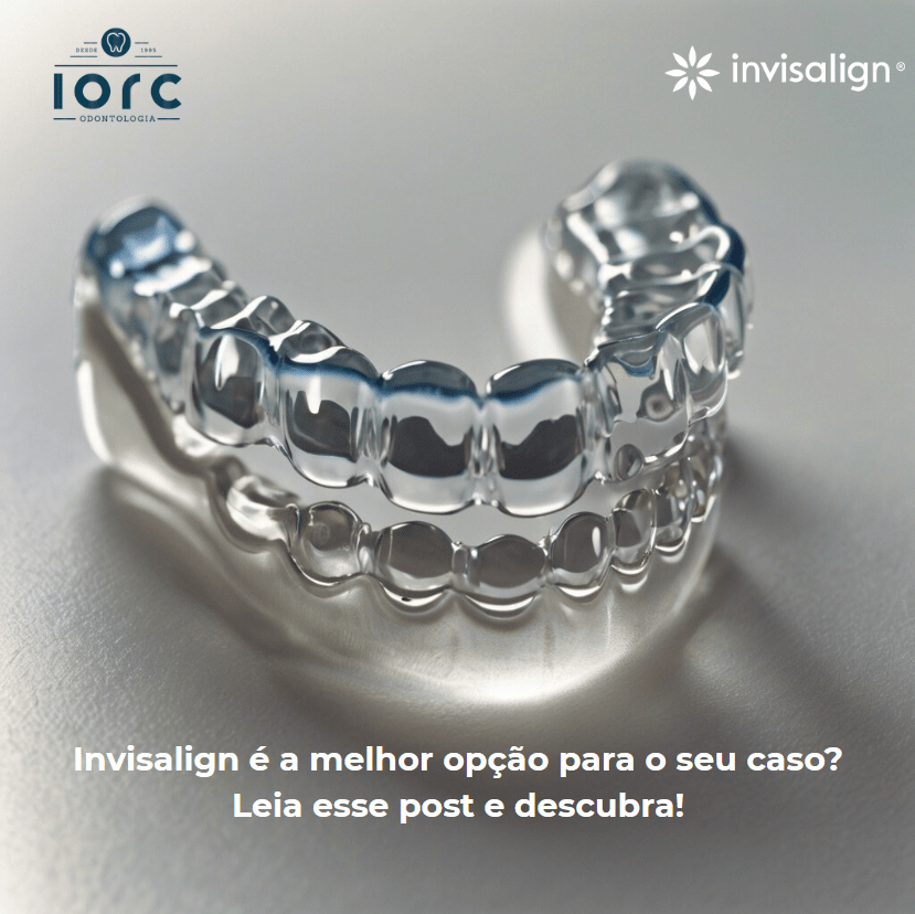 Invisalign ou Aparelho Fixo: Qual a melhor escolha para o seu caso? - IORC Odontologia