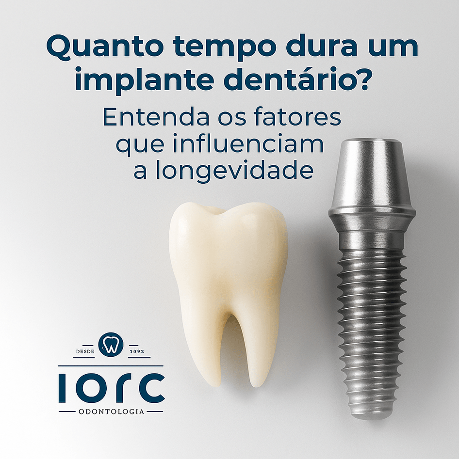 Quanto tempo dura um Implante Dentário? - IORC Odontologia
