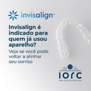 Invisalign é indicado para quem já usou aparelho? 1 - IORC Odontologia Invisalign é indicado para quem já usou aparelho? - IORC Odontologia