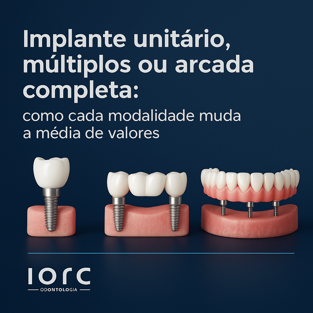 Implante unitário, múltiplos ou arcada completa: como cada modalidade muda a média de valores - IORC Odontologia