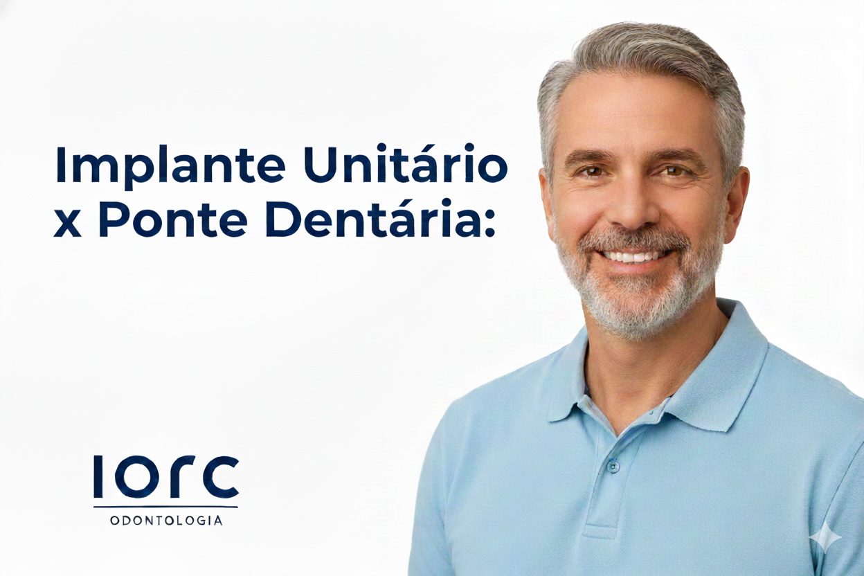 Implante unitário x ponte dentária: qual é a melhor opção para substituir um dente perdido? - IORC Odontologia