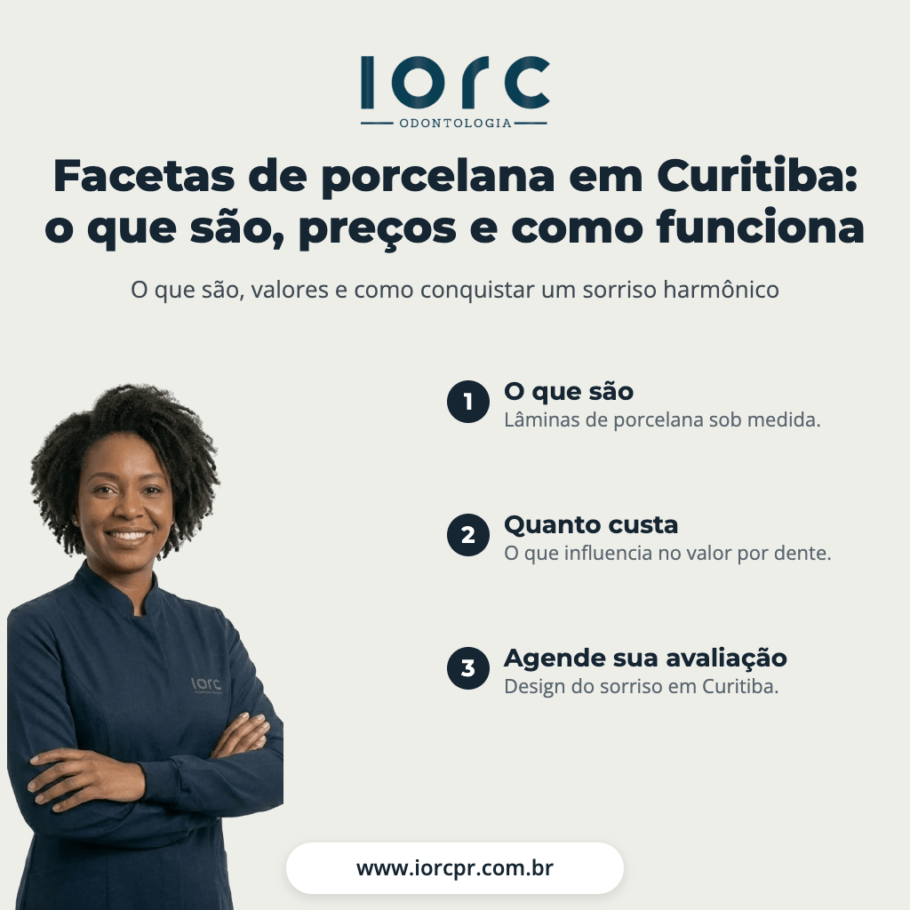 Facetas de porcelana em Curitiba: o que são, preços e como funciona